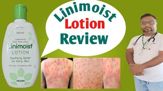 Linimoist Lotion Review || ছালত কি কি বেমাৰ হলে লগাব পাৰিব সম্পূৰ্ণ জানি লওঁক || health tips ikbal