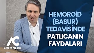 Hemoroid (Basur) Tedavisinde Patlıcan'ın Faydaları