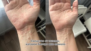 Экзема,дерматит,народное средство которое быстро помогает.