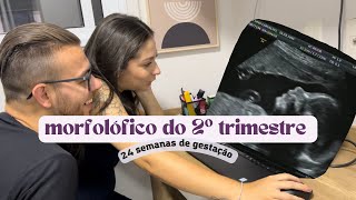 MORFOLÓGICO DO 2º TRIMESTRE - um dos exames mais importantes da gestação