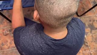 Dandruff Scratching |My Son #3