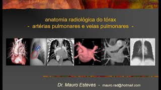 Anatomia - Artérias e veias pulmonares