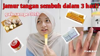 PAKAI OBAT INI‼️KUTU AIR, JAMUR, ALERGI SABUN CUCI SEMBUH DALAM 3HARI PENGALAMAN PRIBADI