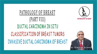 DUCTAL CARCINOMA IN SITU | CLASSIFICATION OF BREAST TUMOR | INVASIVE DUCTAL CARCINOMA (Part 8)