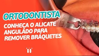 Dica de Ortodontia - Como retirar bráquete de molar do aparelho ortodôntico usando alicate angular