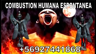 COMBUSTION HUMANA ESPONTANEA