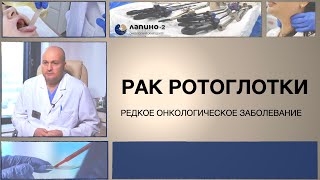 Рак ротоглотки: симптомы, диагностика, лечение.