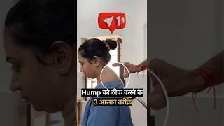 How to fix your neck hump | Neck हम्प को ठीक करने का आसान उपाय |