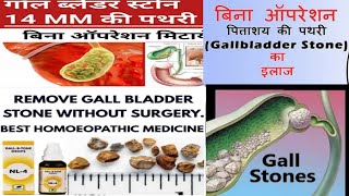 Best Medicine For Gall Bladder Stone // New Life Ka NL-4 Drops For Gall Bladder Stone//HM4U Roorkee.