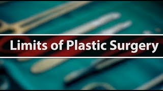 Limits of Plastic Surgery