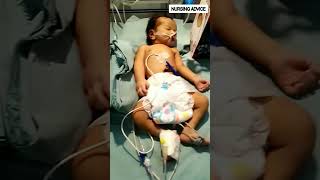 This Newborn Baby on a Ventilator Machine NICU #ventilator #shortsviral #nurse #baby #newborn