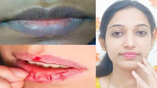 ಕೆಂಪು ತುಟಿಗಳಿಗಾಗಿ ಹೀಗೆ ಮಾಡಿ ನೋಡಿ||Get Soft Pink Lips in 10 Minutes