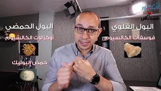 ما هي أنواع حصوات الكلى؟