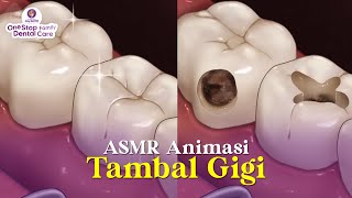 animasi tambal gigi