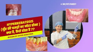 Hyperkeratosis (मुँह की चमड़ी का मोटा होना ) क्या है ,कैसे होता है ??