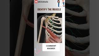 Identify the Muscle of upper limb quiz #upperlimbanatomy #anatomy #humananatomy