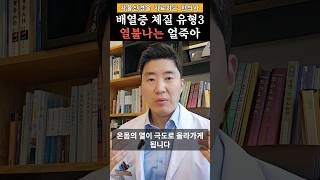 배열증이 생기기 쉬운 체질(3)ㅣ배열증한의원 #배열증원인 #배열증병원 #shorts