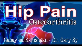 Hip Pain: Osteoarthritis - Dr. Gary Sy