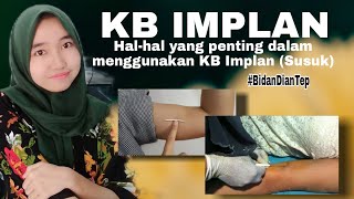 KB IMPLAN/SUSUK. INI HAL PENTING YANG WAJIB TAHU