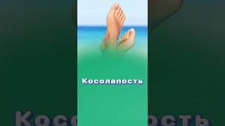 Косолапость в подростковом возрасте #косолапость #центрздоровья #титовцентр