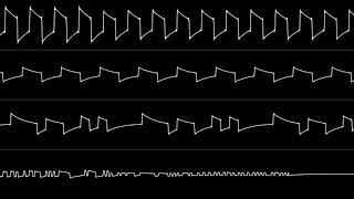 VinsCool - "Sonic 3 - Special Stage" (Atari PoKEY)