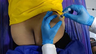 وانەی بیست و چوار(٢٤و): وانەی کرداری دەرزی لێدان لە ماسولکەی پشتەوەی سمت Dorsogluteal site