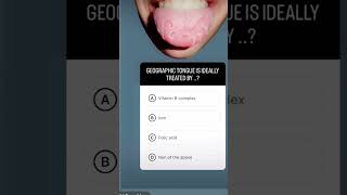 Geography Tongue & its Treatment#neetmdspreparation #oralpathology #medicine #dentalnotes