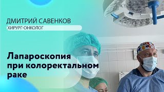 Дмитрий Савенков I Лапароскопия при колоректальном раке