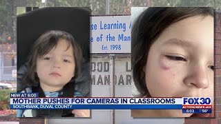 Local mom pushes for cameras in classrooms after son severely injured | Action News Jax