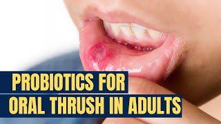 Probiotics For Oral Thrush In Adults | Probiotiv Naturals