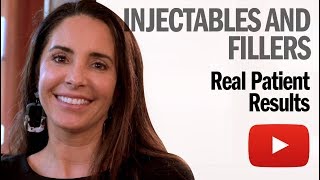 Injectables And FIllers - What are the results? - Real Patient Story