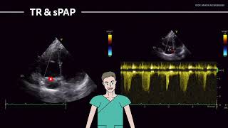 〖Echocardiography〗 PW Doppler MV, TAPSE, sPAP measured in the apical views 💖