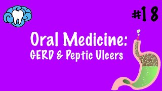 Oral Medicine | GERD & Peptic Ulcers | INBDE