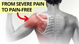 SHOULDER PAIN: Our 3 Phase Approach from Severe Pain to Pain Free