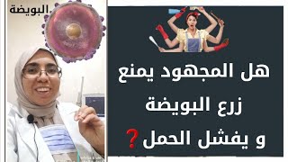 هل المجهود يمنع زرع البويضة و يفشل الحمل د. ريهام الشال