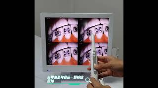 Intraoral camera