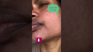 dry skincare routine🎀 | morning skincare routine🥰 | #amskincare #dryskincareroutine #viral #trend