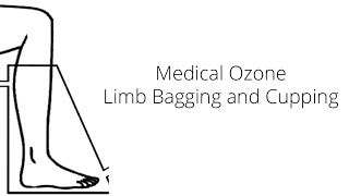 Medical Ozone Limb Bagging and Cupping