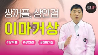 쌍꺼풀, 상안검 수술하러 왔는데 이마거상 추천? 미간주름, 콧등 주름은 보너스! - 연세UP성형외과