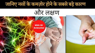 नसों में ब्लॉकेज, नसों में दर्द में व अकड़न , नसों की कमजोरी, Nerve Pain , नसों में खिंचाव, दबी नस