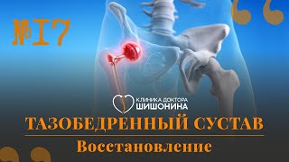 Как забыть о боли в тазобедренных суставах: отвечает хирург в новом выпуске «Хорошей медицины» ❗️