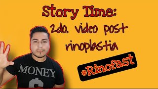 Story Time:  2da parte de mi Rinoplastia