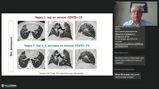 Медицинский форум "Long Covid междисциплинарная проблема     сконвертированный" 27.04.2023