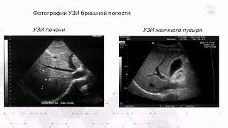 Ультразвуковое исследование органов брюшной полости