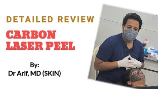 CARBON LASER PEEL/ LASER TREATMENT By Dermatologist ​⁠@DrArifMDDermatologist #carbonlaserpeel