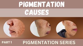 Pigmentation Causes