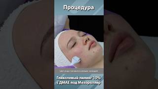 Процедура Гликолевый пилинг 10% с ДМАЕ под Мезороллер #skincare #акне #косметолог #пилинг