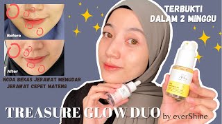 REVIEW everSHINE TREASURE GLOW DUO - PEMAKAIAN 2 MINGGU | PEELING GLOW SERUM + BAKUCHIOL SERUM