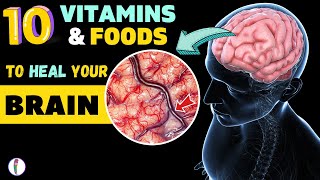 10 Incredible Foods for your Brain & Mental Health | Brain Food | Mental Health | Depression