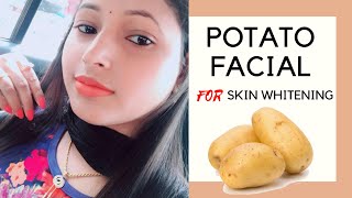 Potato Facial At Home For Skin Whitening || Remove Dark Spots, Face Pigmentation on Face and Body